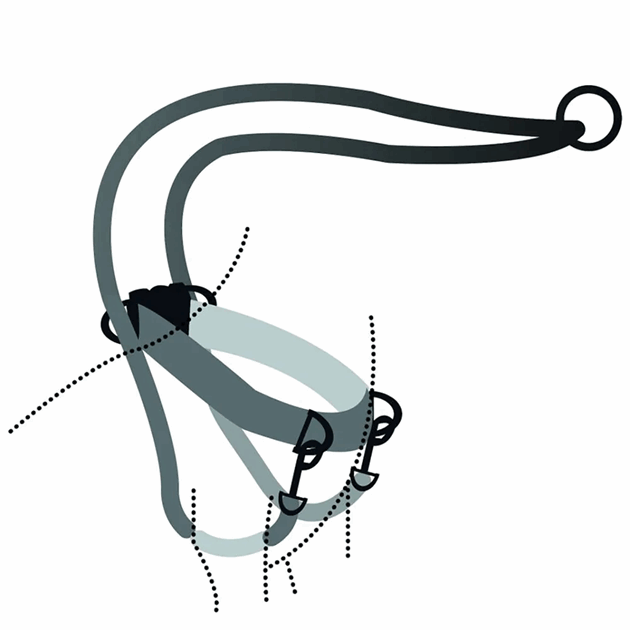 Z009534_Rel Z009534_2.png
